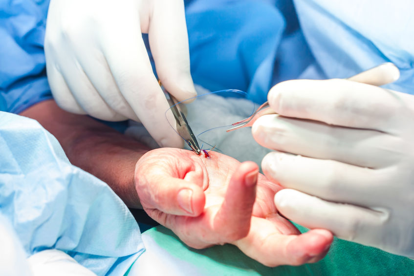 Minor-Surgical-Procedures